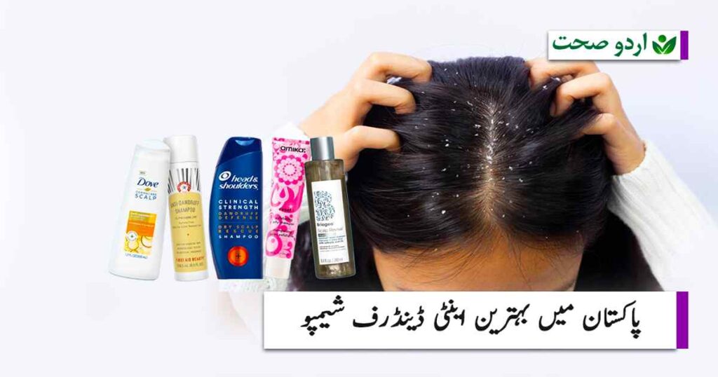 Best Anti Dandruff Shampoo in Pakistan