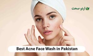 Read more about the article Acne Face Wash in Pakistan: Everything You Need to Know